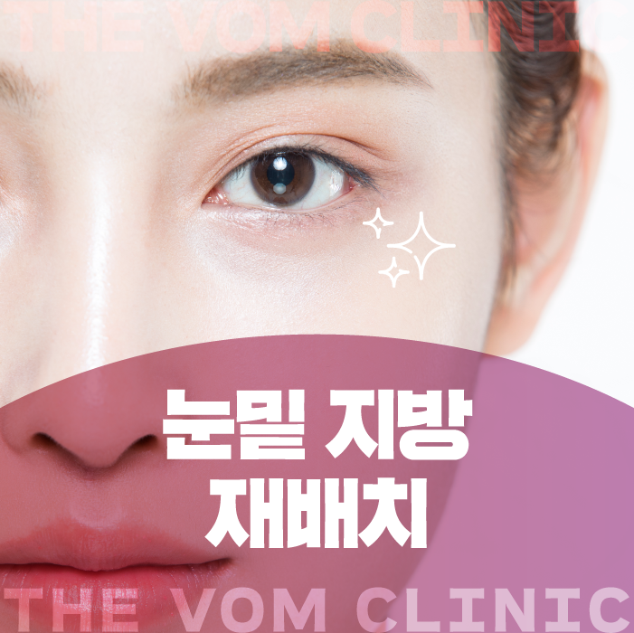 일산 눈밑지방재배치, 다크서클 개선 방법이 궁금하다면?